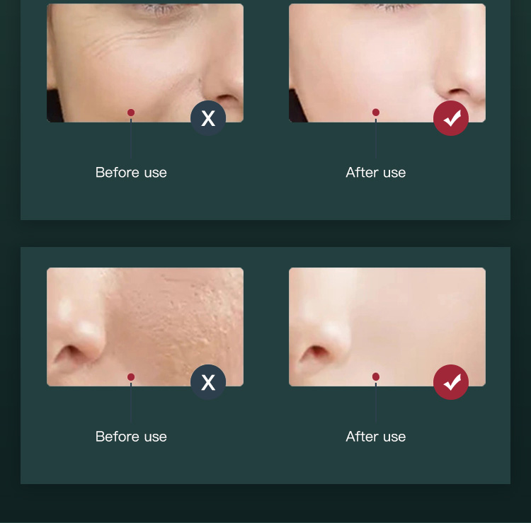 red light blue light therapy