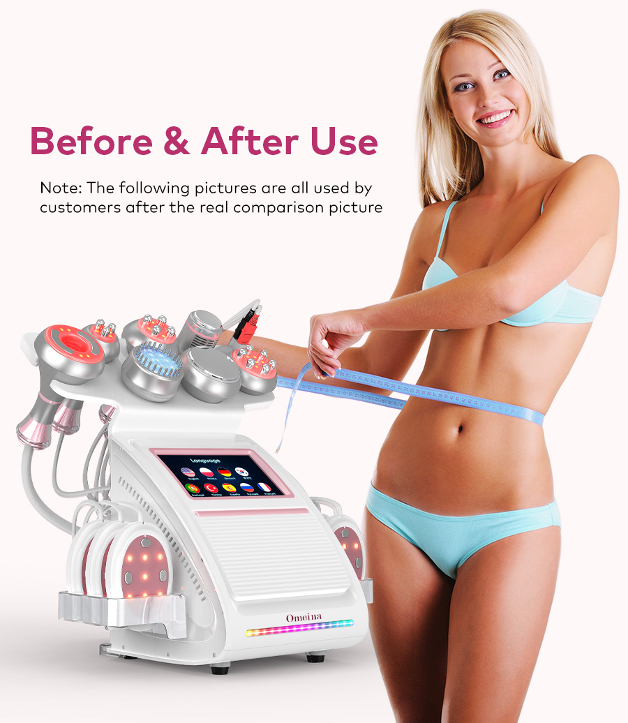 Omeina ultrasound fat cavitation machine