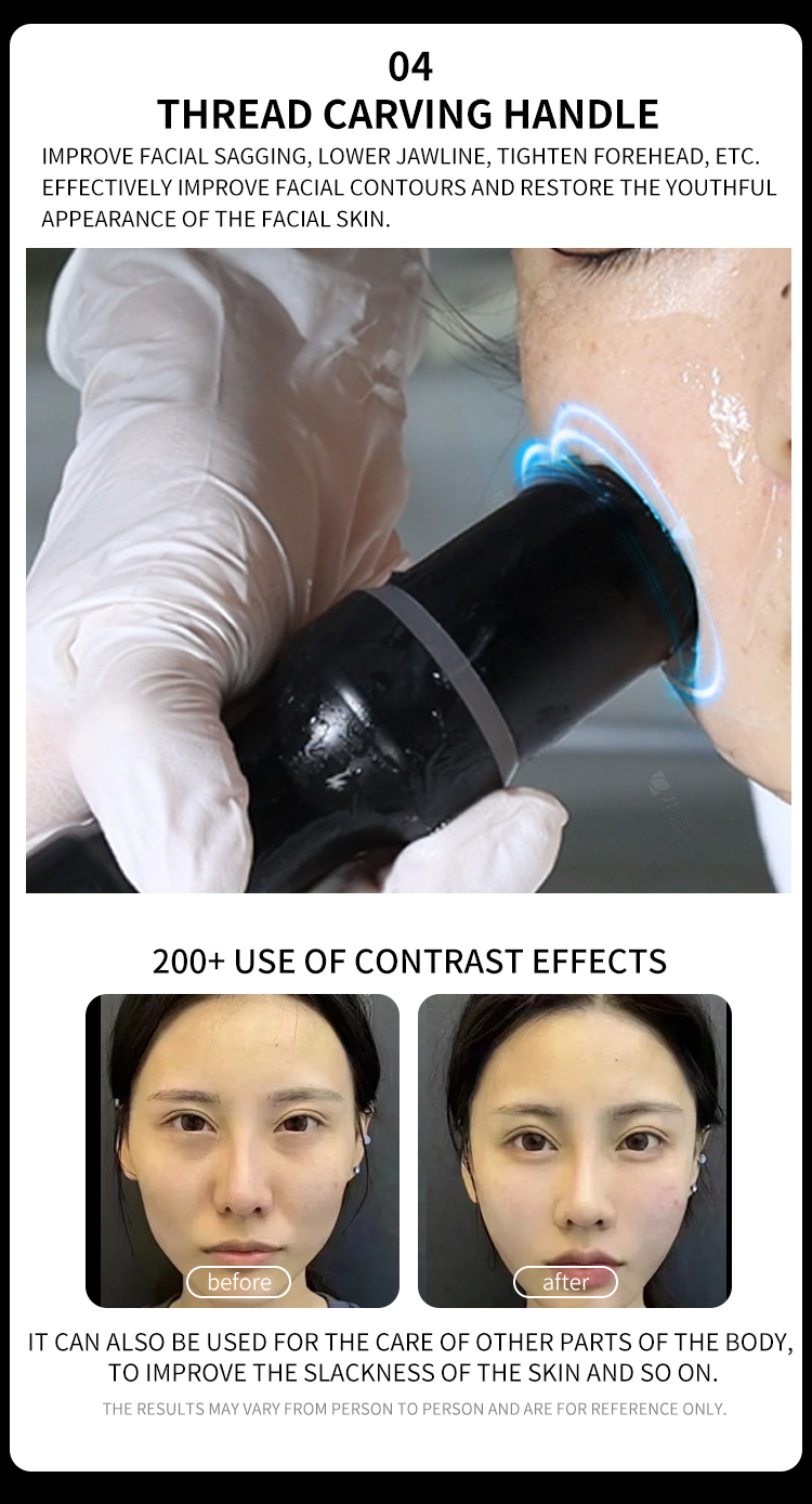 Professional HIFU facial machine