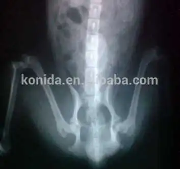 Medical xray laser film Konida blue based film Agfa 14*17 dry film DT2B