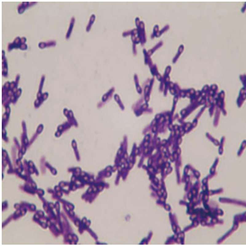 Bacillus Coagulans