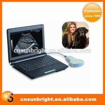 Laptop ultrasounds /ultrasound technician Medical Ultrasound Equipment