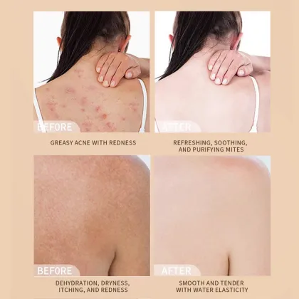 OEM All-in-One Sulfur Liquid Soap: Mite Remover, Moisturizing Face Wash & Body Wash for Sensitive Skin