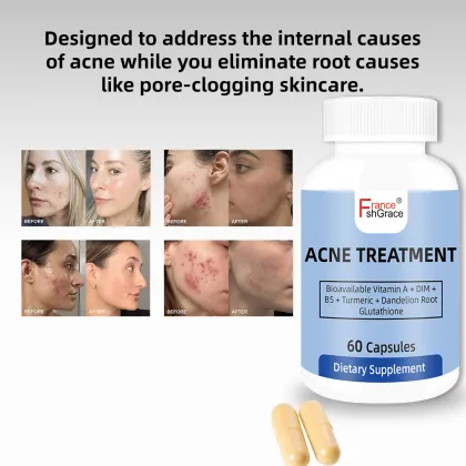 Shecome Acne Capsules Skin Health Support