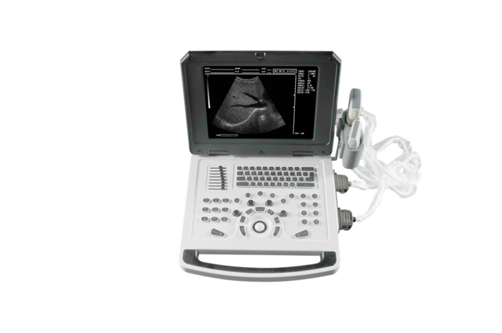 Notebook Color Doppler Ultrasound Machine for Abdomen