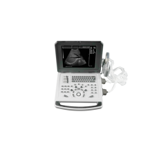 Notebook Color Doppler Ultrasound Machine for Abdomen