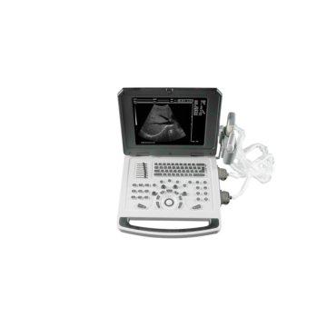 Machine à ultrasons Doppler de couleur pour l&#39;abdomen