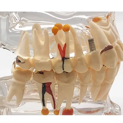 Orthodontic and Dental Pathological Teeth Model Restoration Study in Medical Science