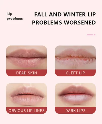 Hot Selling Lip Scrubs: Gently Exfoliate and Remove Dead Skin with Coconut, Peach, and Strawberry Flavors