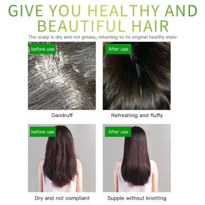 Mokeru Anti-Dandruff Oil Control Shampoo - 500ml