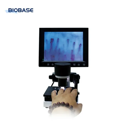 Biobase WXH-8 Microcirculation Individual Microcirculation Monitoring Digital Microscope: Comprehensive Search Engine