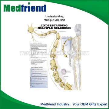 Understanding Multiple Sclerosis Chart