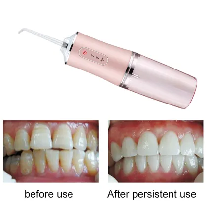 Cordless Portable Electric Teeth Water Flosser for Professional Dental Care