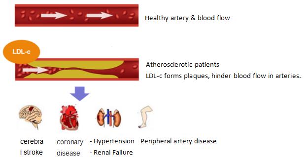 high cholesterol cause diseases