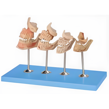 Development of a set of teeth