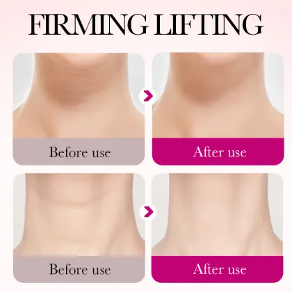 Hexapeptide Compact Neck Cream for Stretch Skin and Fine Grain Neck Care