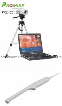 Endoscope of Vdieo Gynecological Colposcope (PRO-CS400)