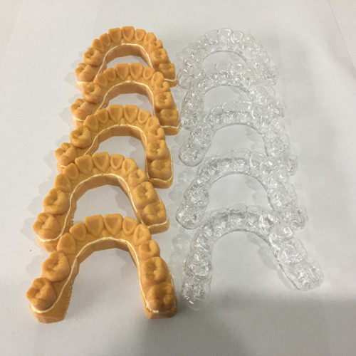 Modello di denti stampati in 3D