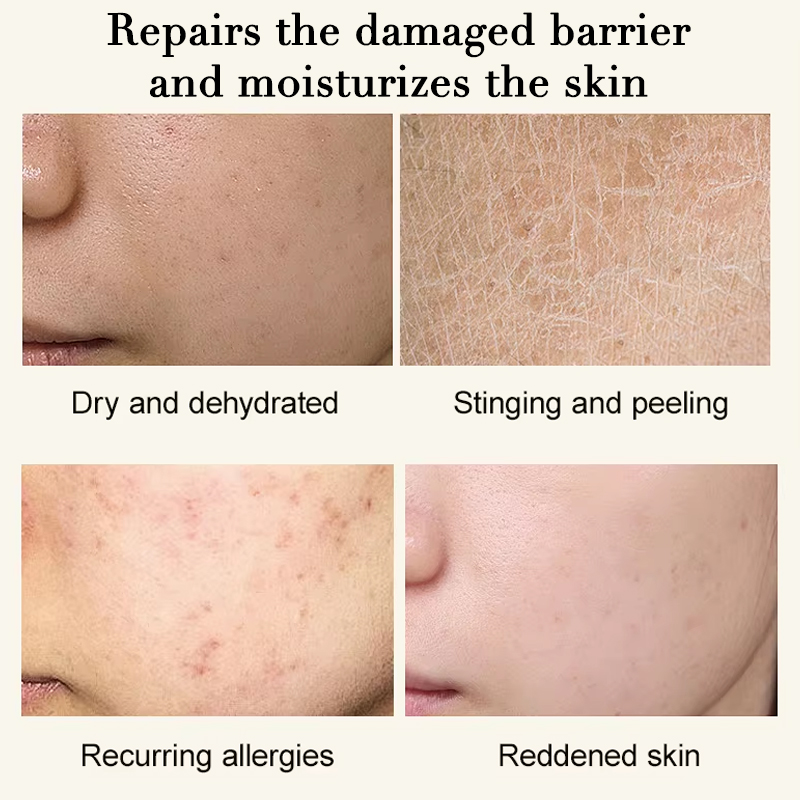 HALORINNA Emergency Soothing Serum5