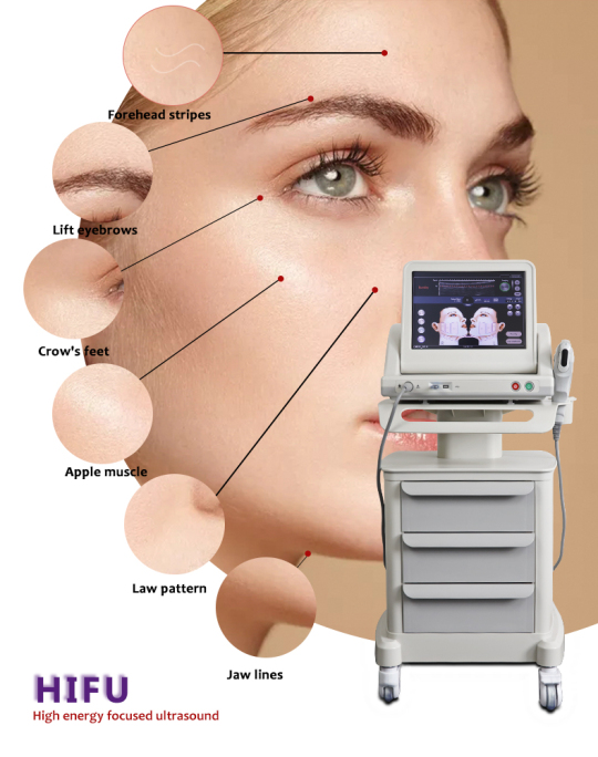 NEW NON-INVASIVE ULTHERAPY SMAS FACE LIFTING SKIN TIGHTENING HIFU MACHINE