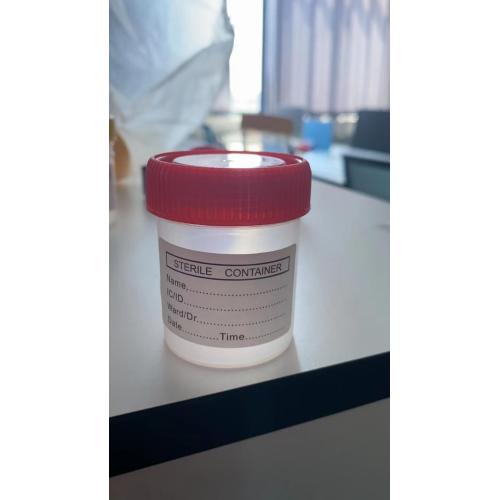 60Ml Disposable Urine Container Disposable Sterile Urine Specimen Collection Container Cup Manufactory