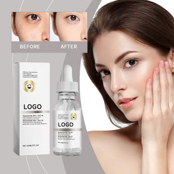 Private Label 10% Nicotinamide Lightening Serum: Dark Spot Corrector & Face Whitening Treatment