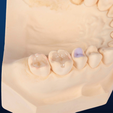 Lithium Disilicate Crown IPS Emax