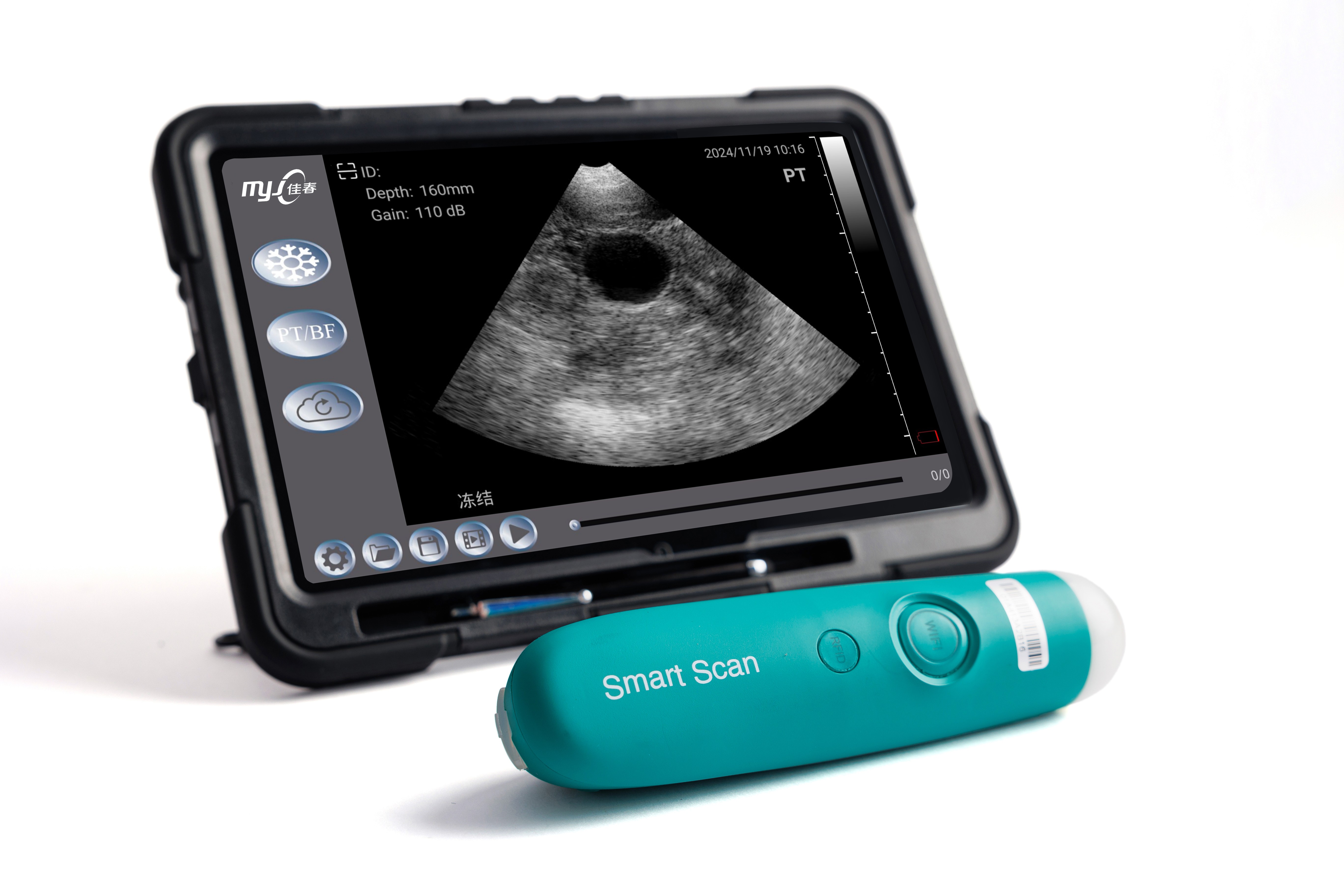 best handheld ultrasound