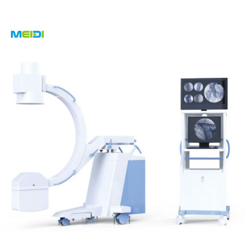 Mobile C Arm x ray machine for hospital
