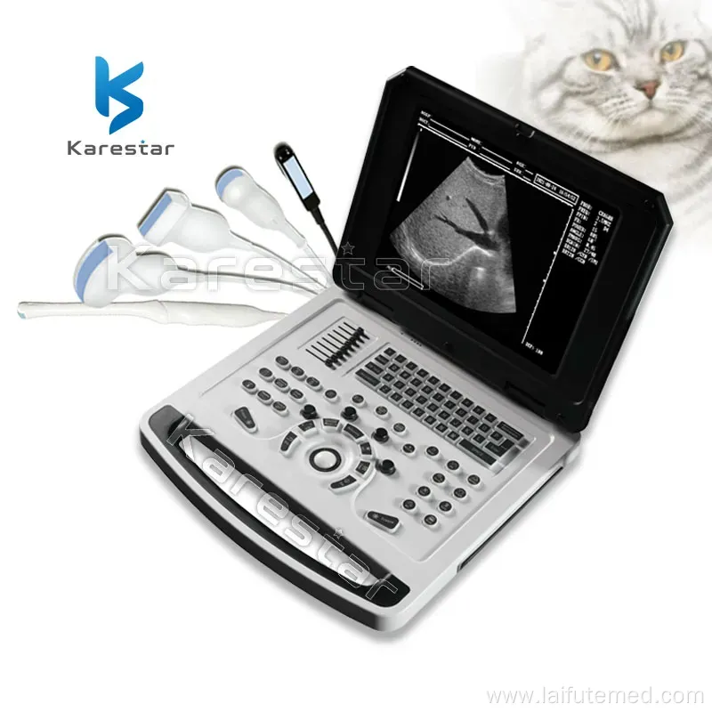 Portable B/W Ultrasound Diagnostic System