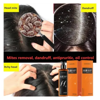 Dr.DMY Luxury Unisex Organic Anti-Dandruff Oil Control Shampoo