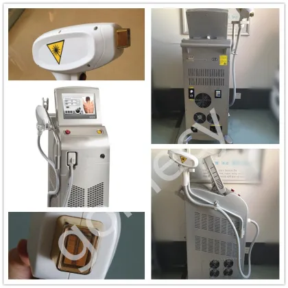 2017 new technology depilation is 808/810nm laser diode Alma laser soprano ice hair system