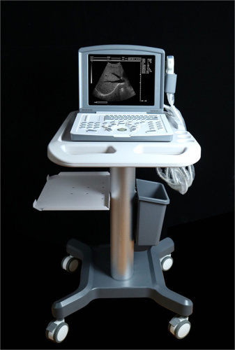 Bärbar full digital diagnostisk ultraljudsscanner