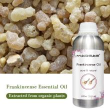 روغن ضروری Frankincense 100 ٪ روغن Frankincense طبیعی ساخته شده است