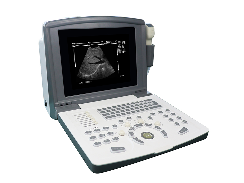 Portable Black and White Ultrasound Scanner