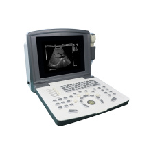 Portable Black and White Ultrasound Scanner