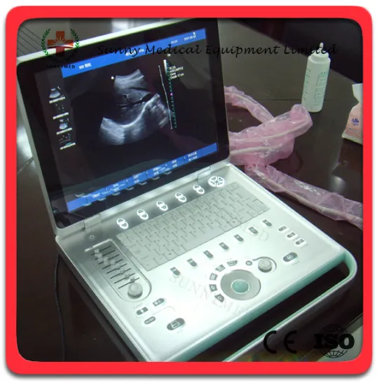 SY-A024 Guangzhou Medical ultrasound device gynecology color ultrasound