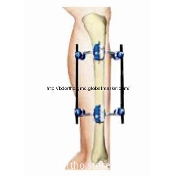 T Fixator Examples Orthopedic External Fixator : Tibia Fixator, High Quality Orthopedic ...