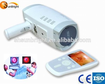 electronic colposcope software/electronic gynecatoptron