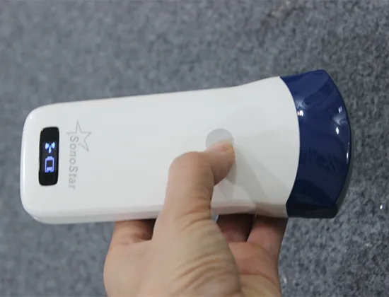 Convex Series Probe Type Wireless Mini Ultrasound Scanner