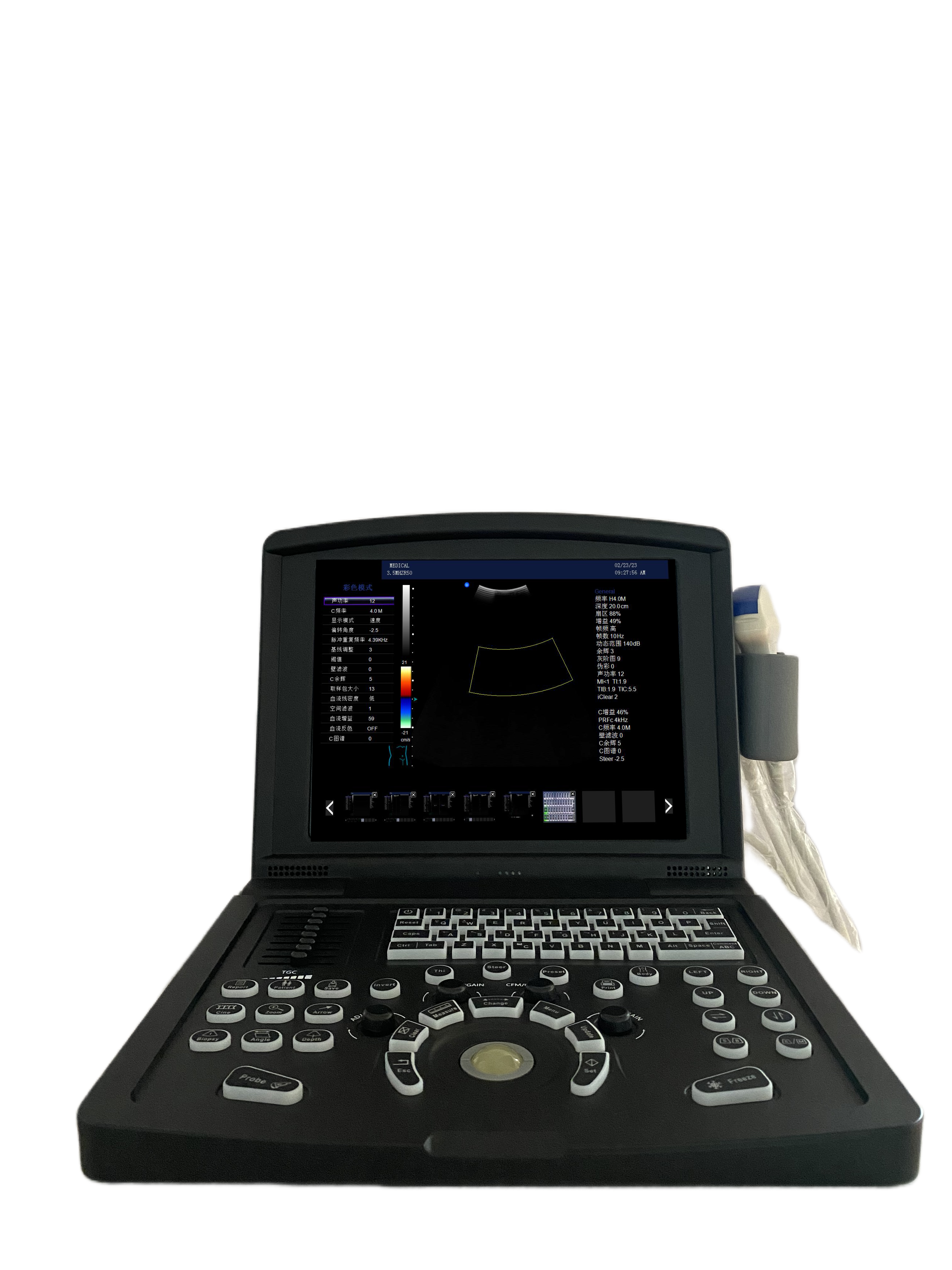 Supply Portable Color Doppler Ultrasound Scanner for Vascular with High ...