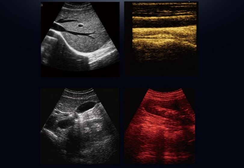 black and white ultrasound scanner