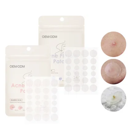 Wholesale Custom Shape Acne Patches with Acne Treatment