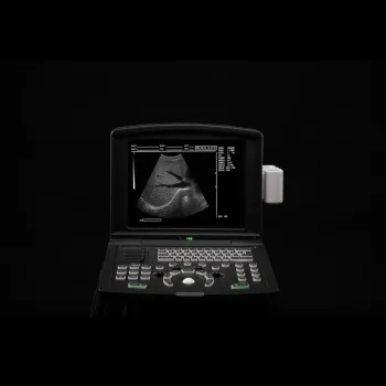 MDK-660B portable black and white ultrasound machine