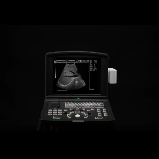 MDK-660B portable black and white ultrasound machine