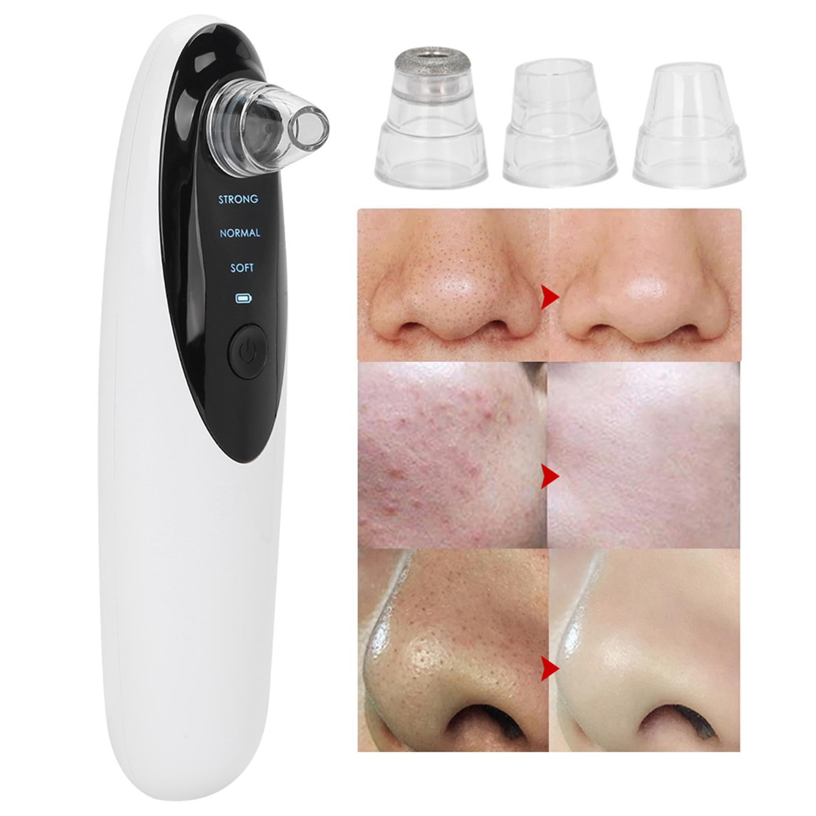 Miniature DC vacuum pump for blackhead removal devices