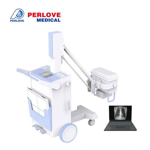 Plx5100 Mobile Digital Radiography System Radiography X Ray Machine ...