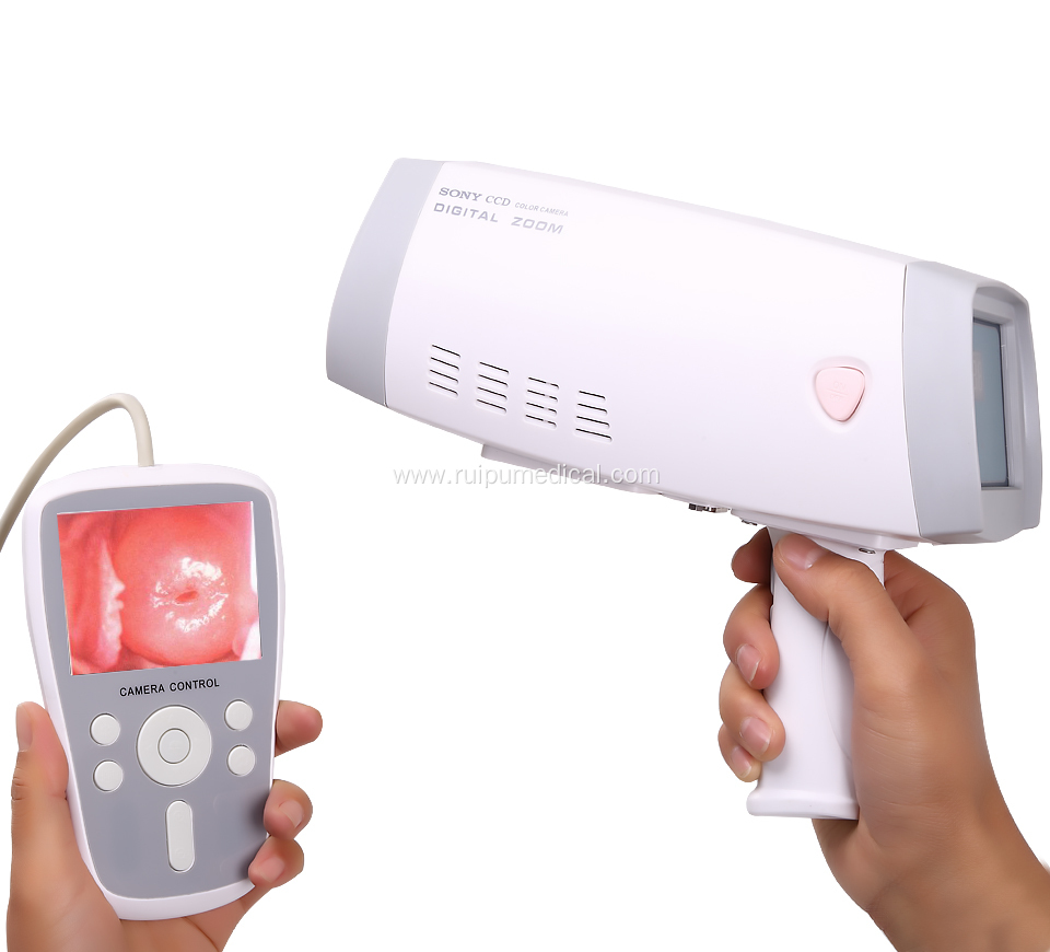 Handheld Digital Full hd Camera for Vagina Colposcope