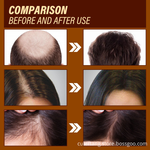 Top Selling Organic Ginger Hair Growth Serum: Your Solution for Strengthened, Repaired Hair Roots