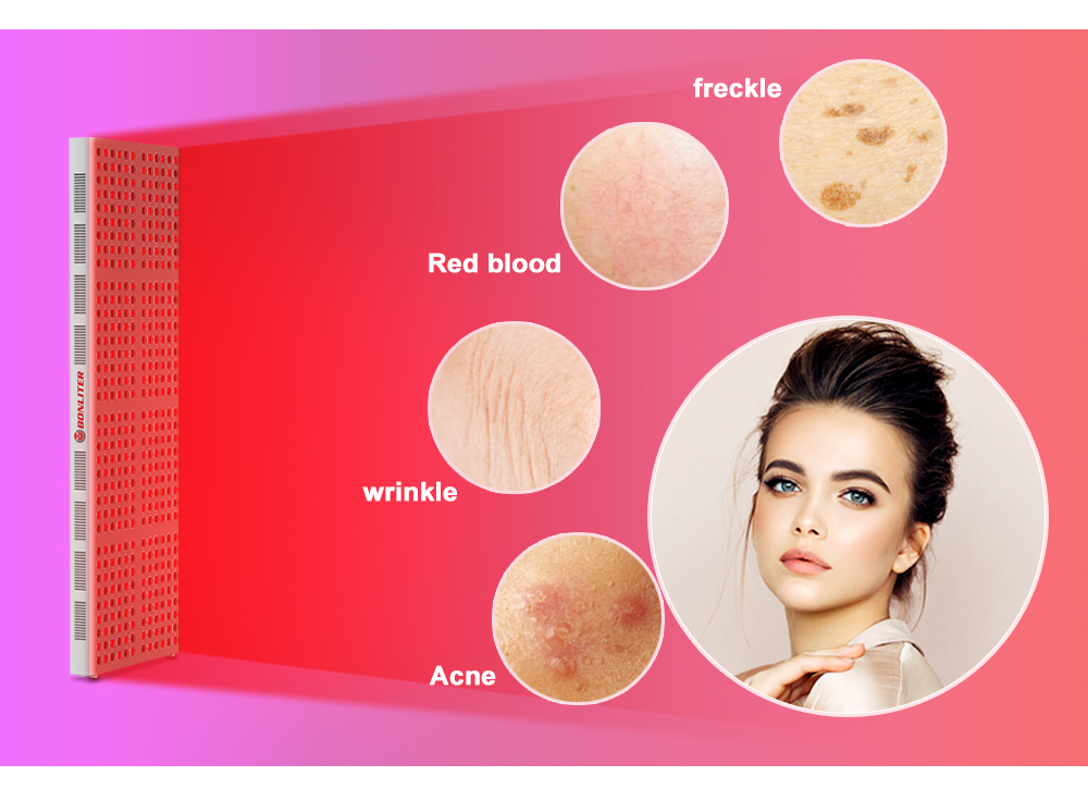 Red Light Therapy Varicose Veins